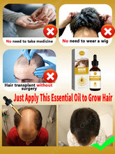 Load image into Gallery viewer, Hair Growth Oil Baldness for men treatment