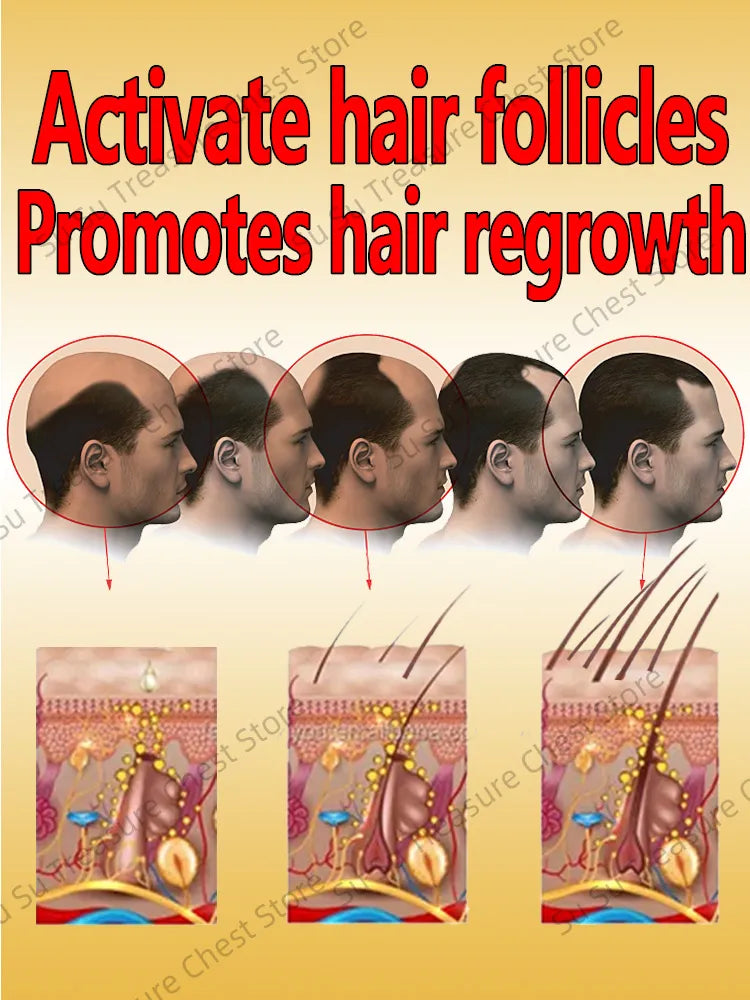 Hair Growth Oil Baldness for men treatment