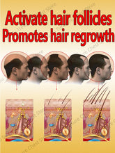 Load image into Gallery viewer, Hair Growth Oil Baldness for men treatment