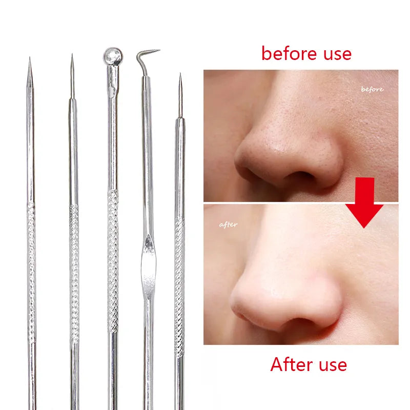 Black Dot Pimple Blackhead Remover Tool Needles For Squeezing Acne Tools Spoon for Face Cleaning Comedone Extractor Pore Cleaner