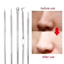 Load image into Gallery viewer, Black Dot Pimple Blackhead Remover Tool Needles For Squeezing Acne Tools Spoon for Face Cleaning Comedone Extractor Pore Cleaner