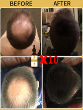 Load image into Gallery viewer, Hair Growth Oil Baldness for men treatment