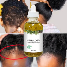 Load image into Gallery viewer, New Fast Hair Growth Serum African Crazy Regrowth Traction Alopecia Hair Loss Prevent Edges Bald Spot Thinnin Hair Treatment Oil