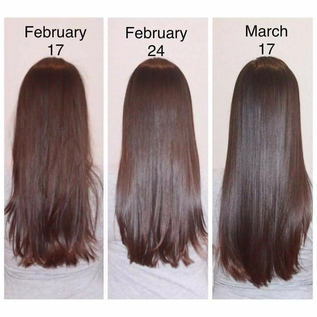 Hair Growth Serum Anti Preventing Hair Loss Alopecia Liquid Damaged Hair Repair Growing Faster