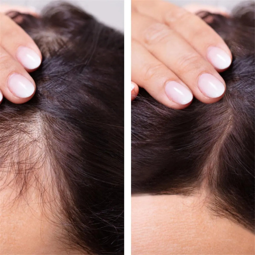 Hair Growth Serum Anti Preventing Hair Loss Alopecia Liquid Damaged Hair Repair Growing Faster