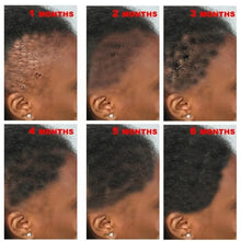Load image into Gallery viewer, New Fast Hair Growth Serum African Crazy Regrowth Traction Alopecia Hair Loss Prevent Edges Bald Spot Thinnin Hair Treatment Oil