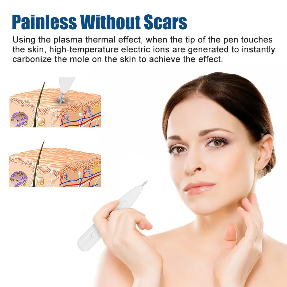 Plasma Pen Face Skin Tag Remover Wart Black Spots Freckle Papillomas Remover Eletric Plasma Jet Pen Skin Care Beauty Devices