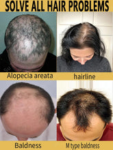 Load image into Gallery viewer, Hair Growth Oil Baldness for men treatment