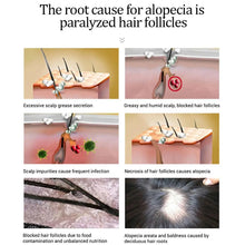 Load image into Gallery viewer, Hair Growth Serum Anti Preventing Hair Loss Alopecia Liquid Damaged Hair Repair Growing Faster